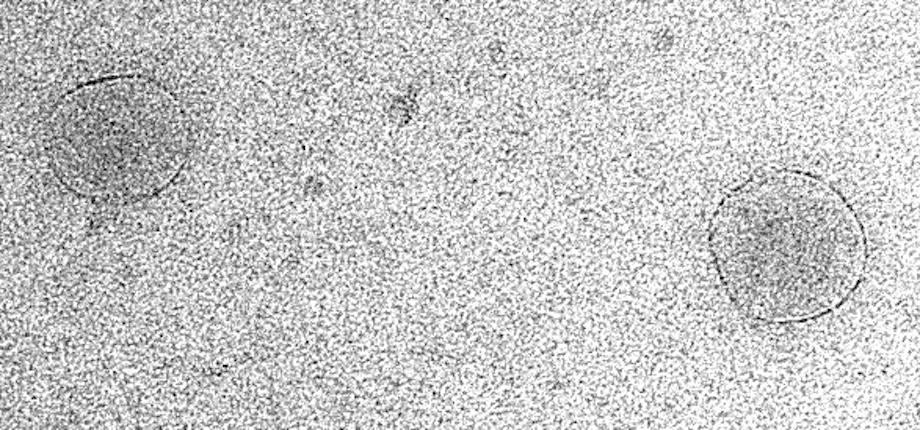 Sécrétion des exosomes : au-delà de la simple fusion membranaire