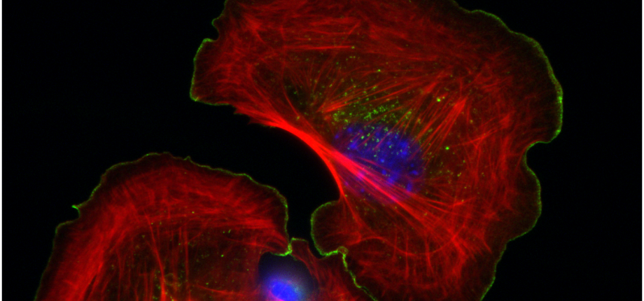 Cytoskeleton and cell morphogenesis