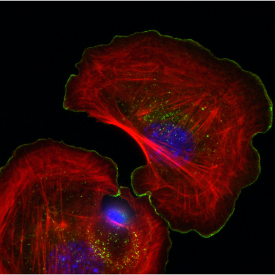 Cytosquelette et morphogénèse cellulaire
